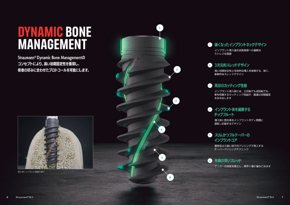 世界シェアNo.1のストローマンインプラント-DYNAMIC BONE MANAGEMENT