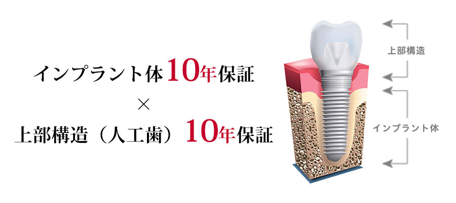 インプラント体10年保証×上部構造（人工歯）10年保証-10年のインプラント保証制度