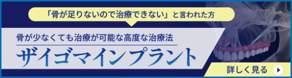 ザイゴマインプラントバナー