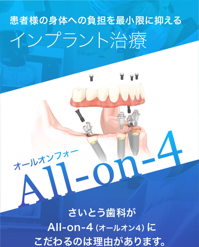 患者様の身体への負担を最小限に抑える。インプラント治療。All-on-4(オールオンフォー)。さいとう歯科がAll-on-4(オールオン4)にこだわる理由があります。