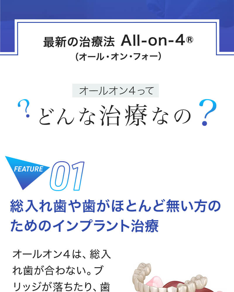 最新の治療法All-on-4(オール・オン・フォー)。オールオン4ってどんな治療なの？feature01-総入れ歯や歯がほとんど無い方のためのインプラント治療。