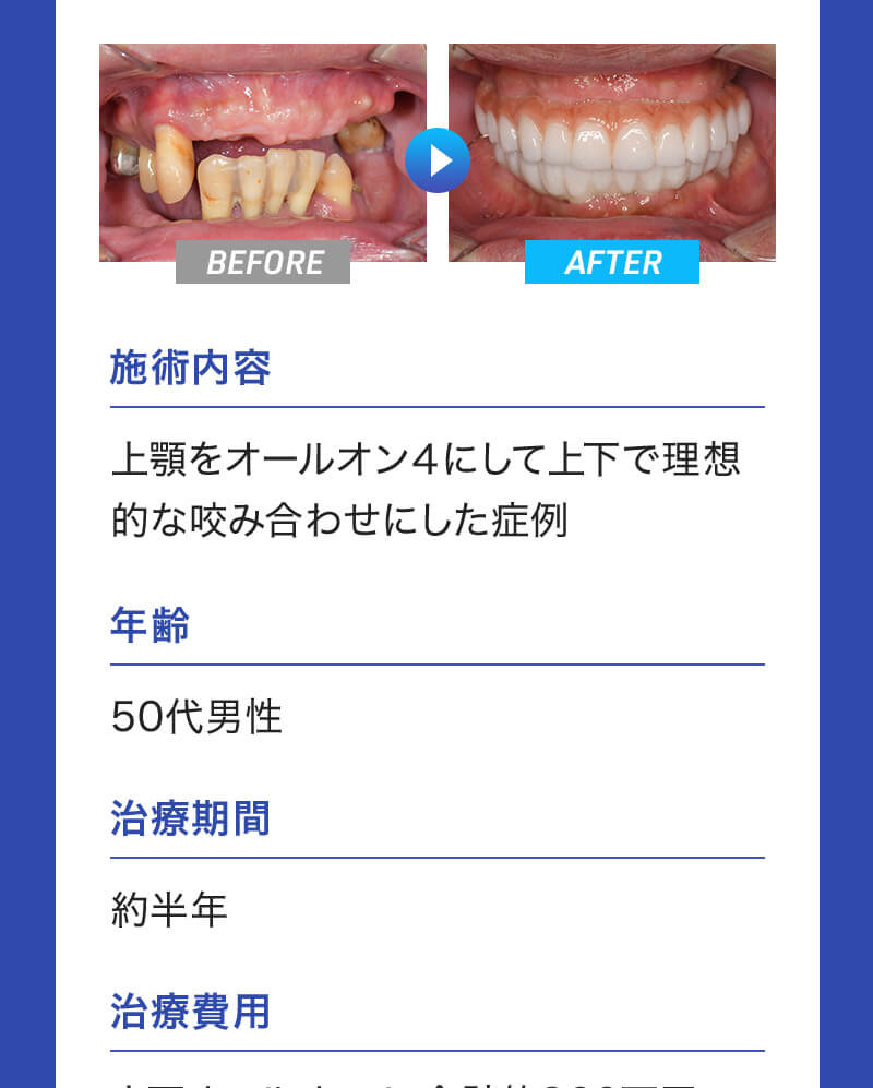 オールイン4の症例 - case1