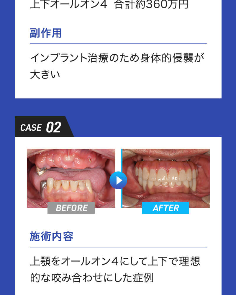 オールイン4の症例 - case2